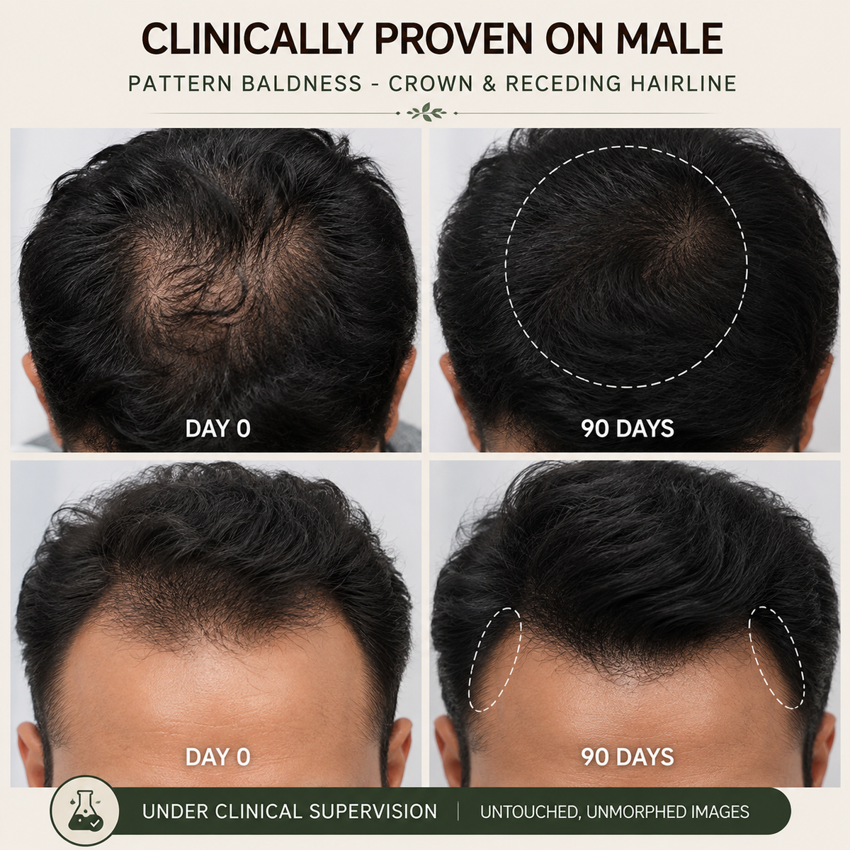 Hair serum for men hair growth