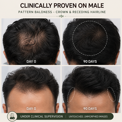 Hair serum for men hair growth