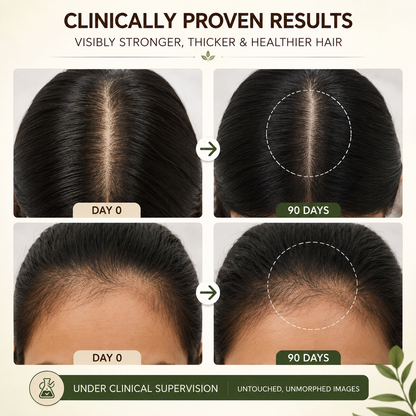 Hair serum for women hair growth